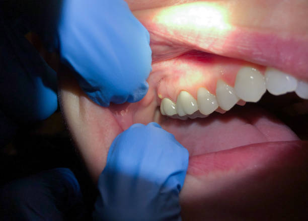 Best Cracked Tooth Emergency Dentist  in Salem, SD